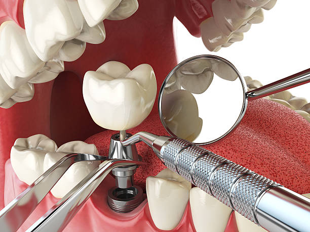 Best Emergency Orthodontic Repairs in Mp Pendleton South, CA